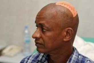 Guinée : Cellou Dalein Diallo frôle le pire, les forces de l'ordre tirent à  balles réélles sur la foule, au moins 4 morts